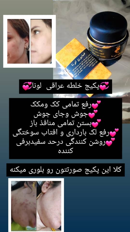 خلطه لونا پک سفیدکننده صورت